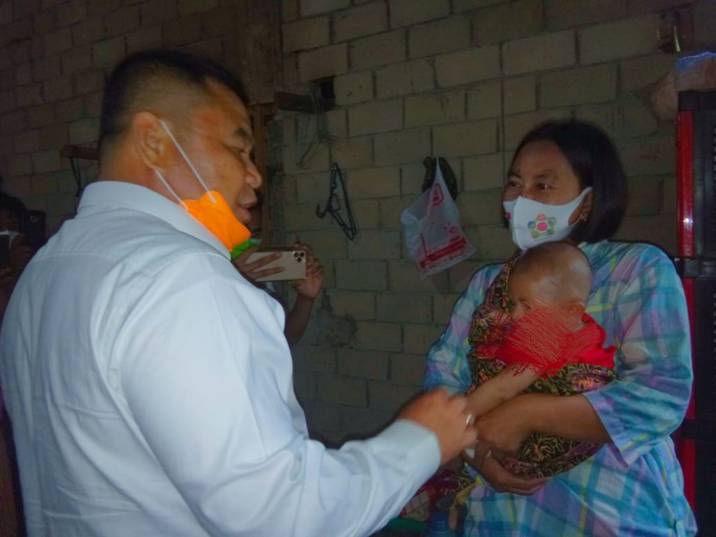 c1-2-1024x768 Operasi Bibir Sumbing, Bupati OI: Silahkan Lapor, Pemerintah Siap Bantu Penyembuhan